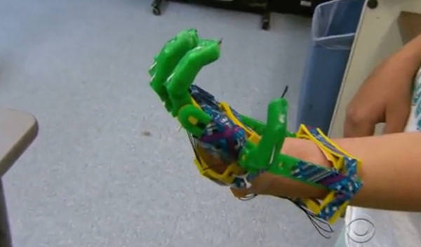 1104-mod-prosthetic-hand_full_600