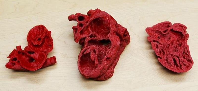 3dheart